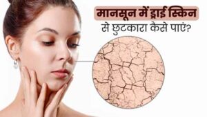 thumb-monsoon-dry-skin-tips