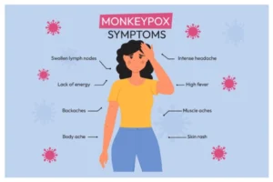 monkeypox-disease-symptoms