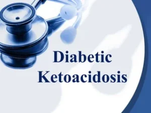 Diabetic-ketoacidosis-